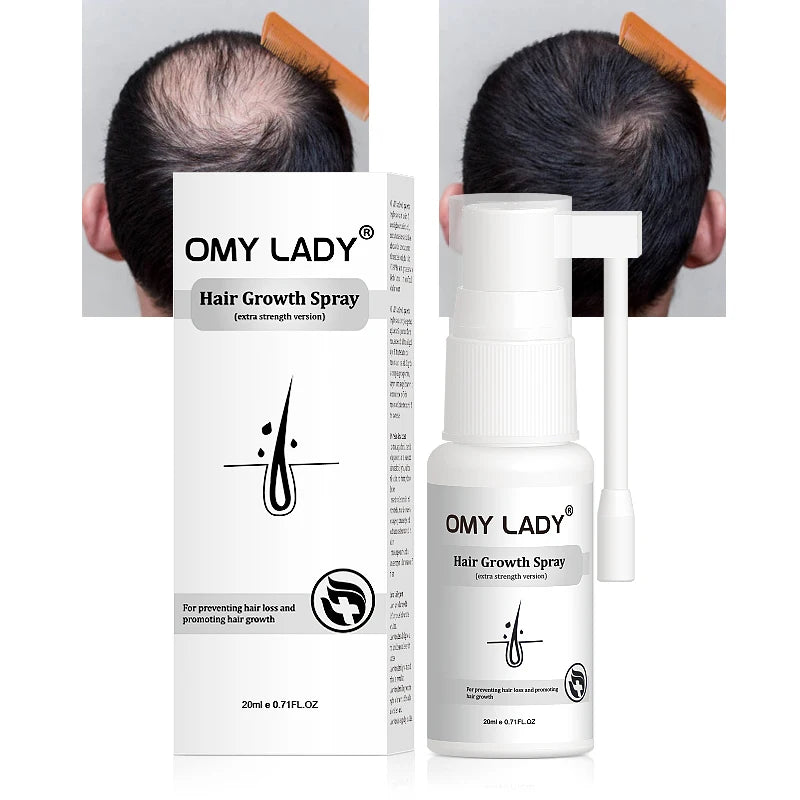 Health Care Supplies OMYLADY Top Selling Organic Hair Growth Lotion Product Organic Hair Growth Spray