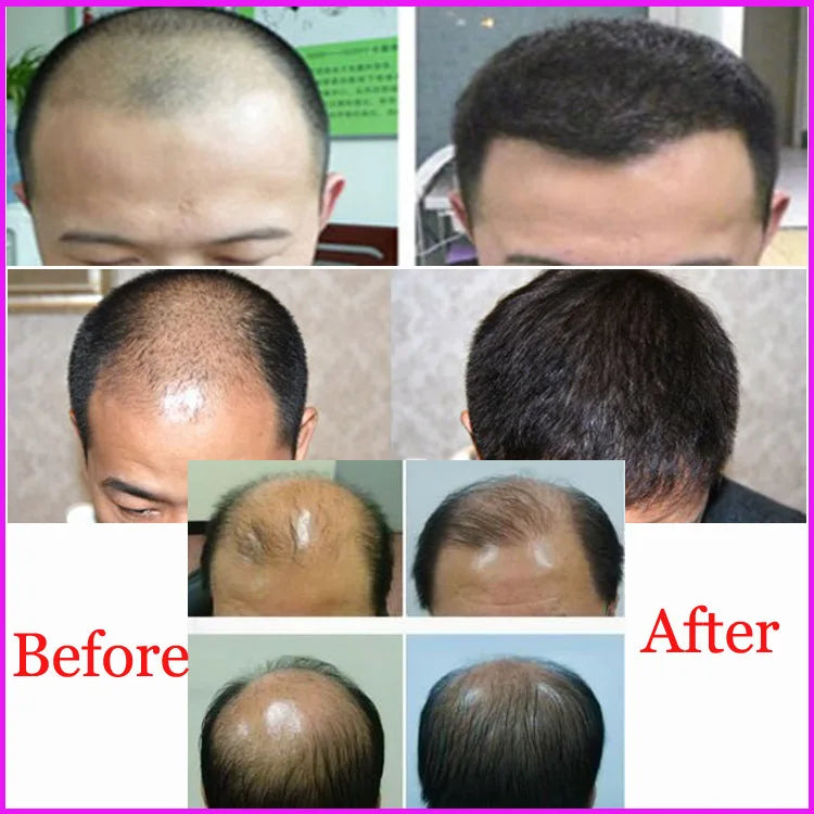 Private Label Hair Care Regrow Oil Products 60ml YUDA Hair Growth Spray for Women & Men