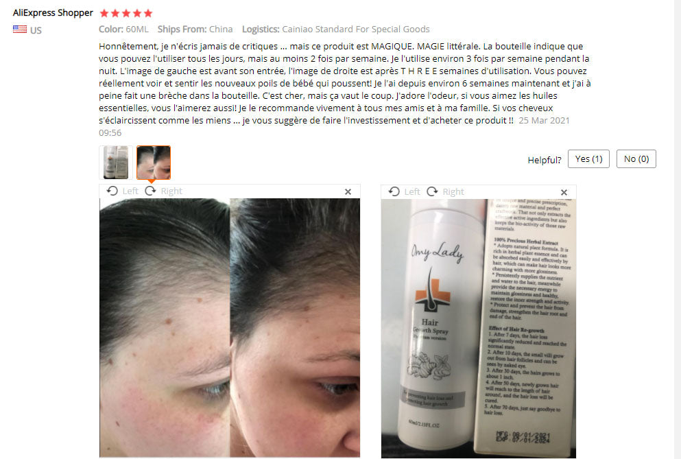 Other Men's Hair Care in USA OMY LADY Sample Free Treatment for Bald Hair Regrowth Serum