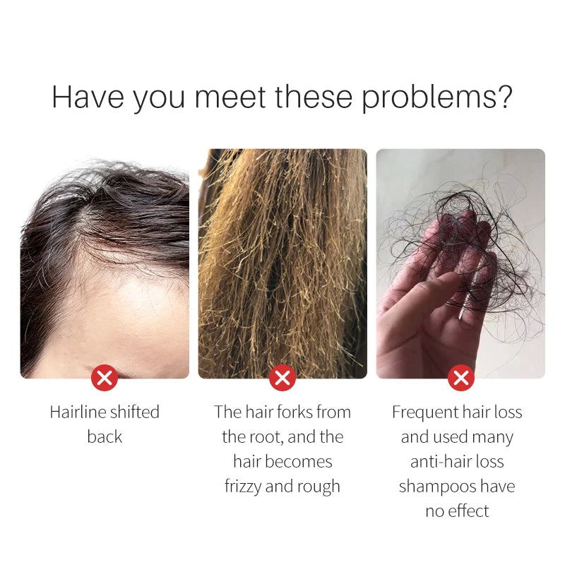 100% Natural Herbal  Organic Vegan Moisturize Hair-Loss Prevention Restores Damaged  Hair Growth Care Rice Water for Hair Serum