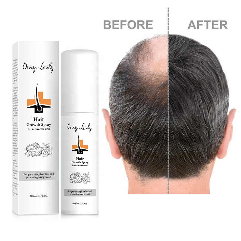 Other Men's Hair Care in USA OMY LADY Sample Free Treatment for Bald Hair Regrowth Serum