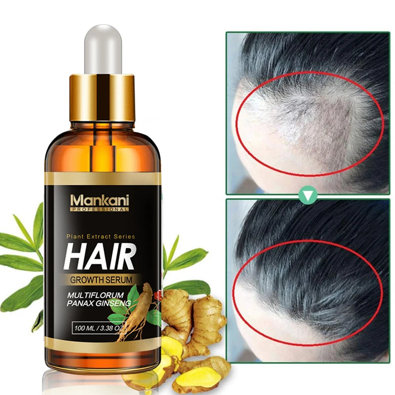 OEM Herbal Infused Argon Oil Hair Care Serum Private Label Natural Hair Growth Treatment Hair Growth Oil