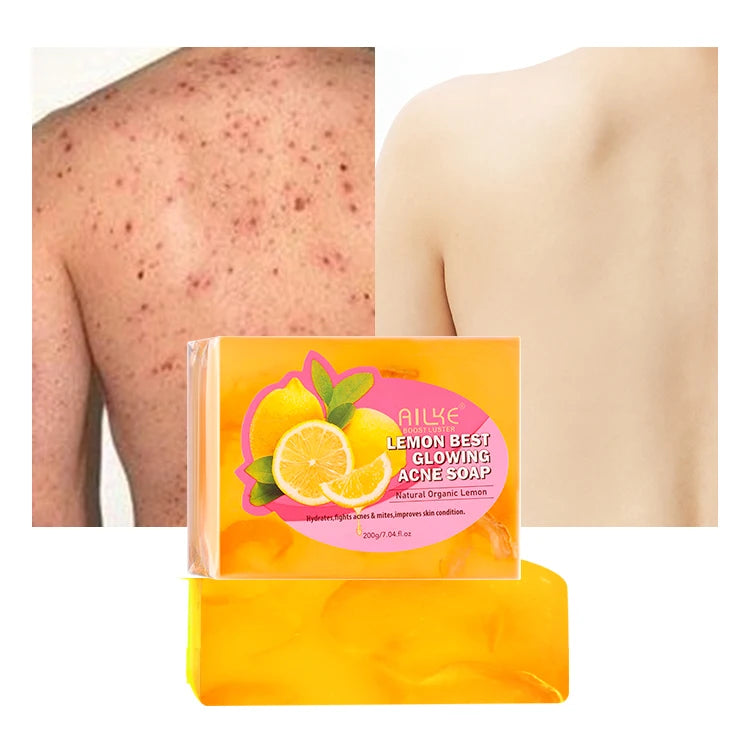 Best Beauty Face & Body Care Salicylic Acid Acne Cream Whitening Plus Lotion Carotene Serum Oil Remove Dark Spots Skin Care Set