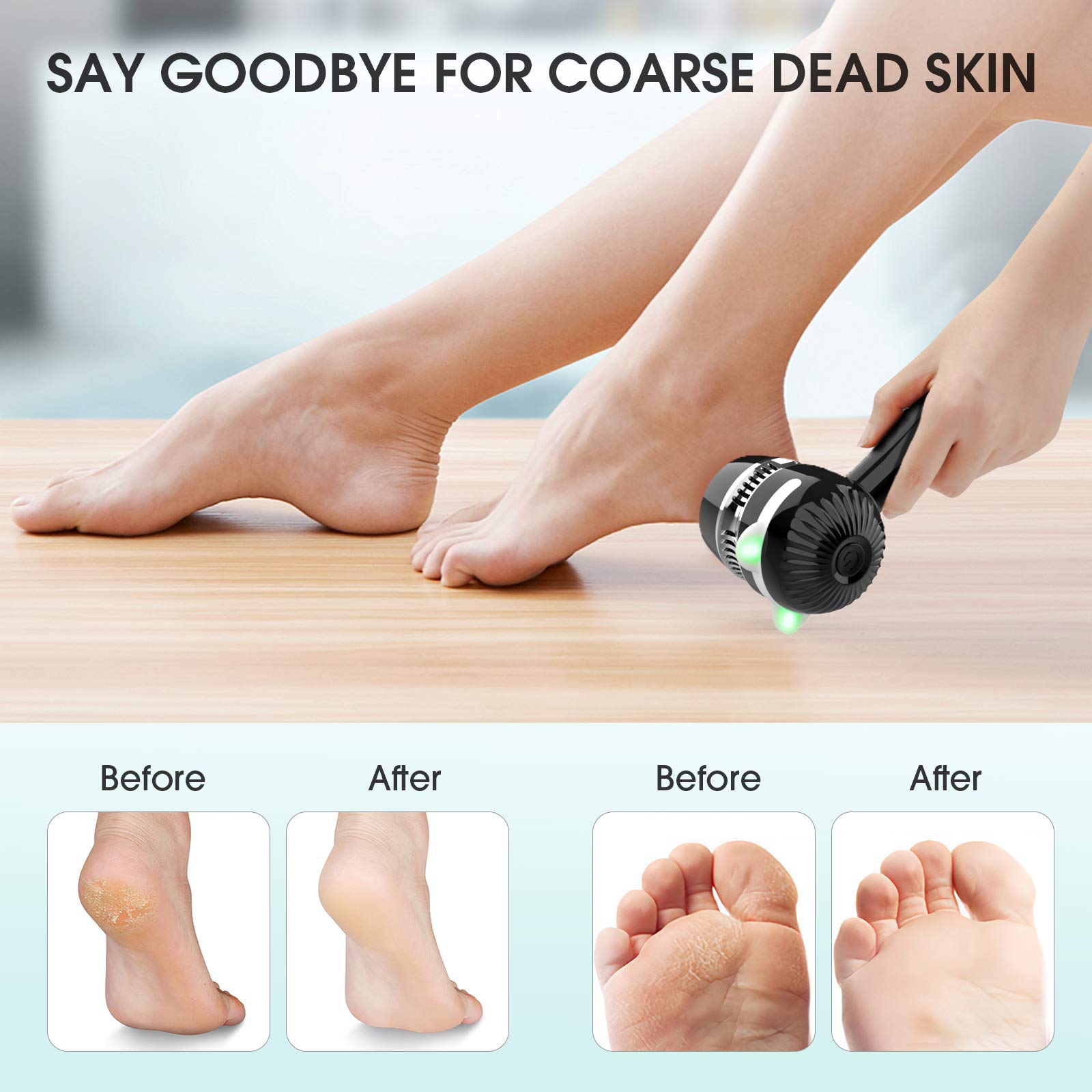 Electric Foot Grinder Vacuum Callus Remover Electric Dead Skin Remover Callus Remover Foot File Pedicure Skin Cleanser Care Tool