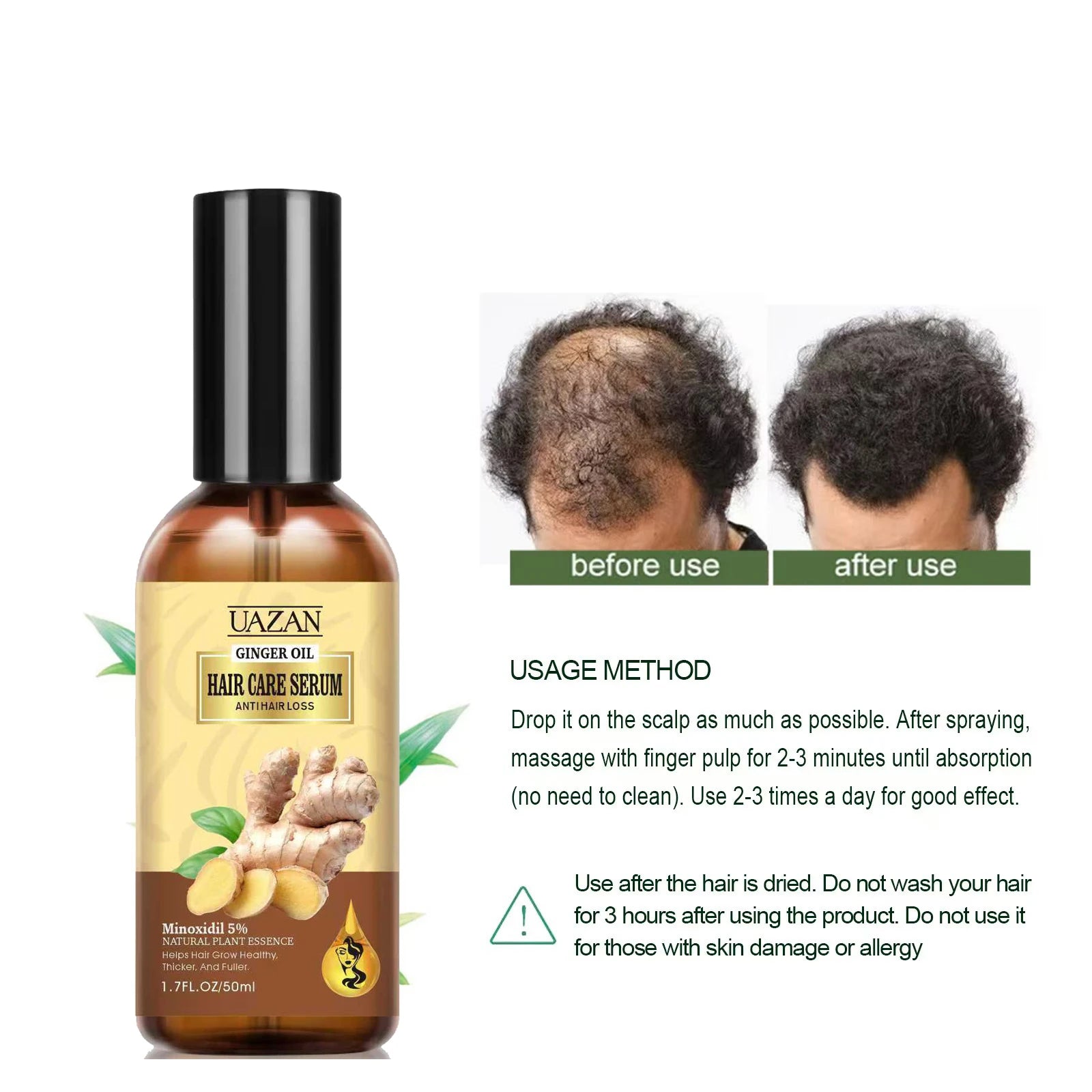 Wholesale 50ml UAZAN Organic Ginger Hair Care Serum Nourishing Scalp Repair Breakage Anti Hair Loss Ginger Hair Growth Oil