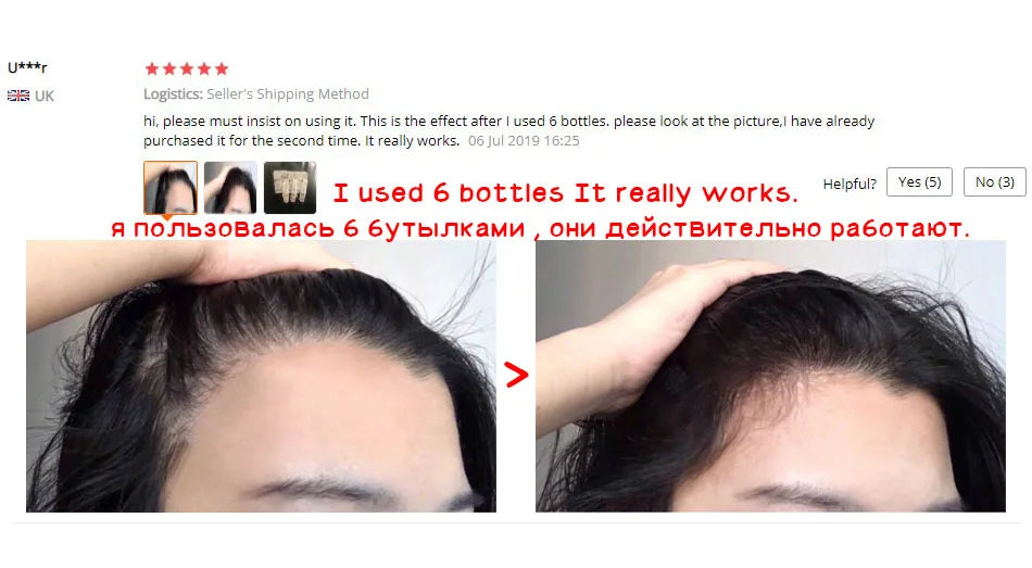 Health Care Supplies OMYLADY Top Selling Organic Hair Growth Lotion Product Organic Hair Growth Spray