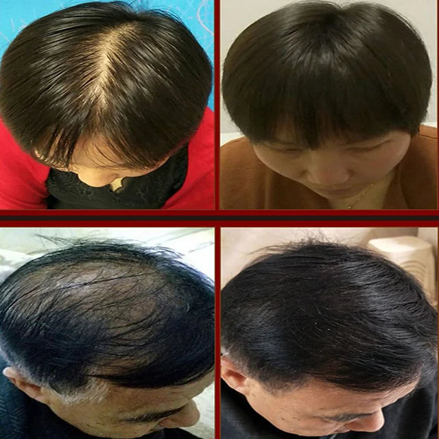 Private Label Hair Care Regrow Oil Products 60ml YUDA Hair Growth Spray for Women & Men