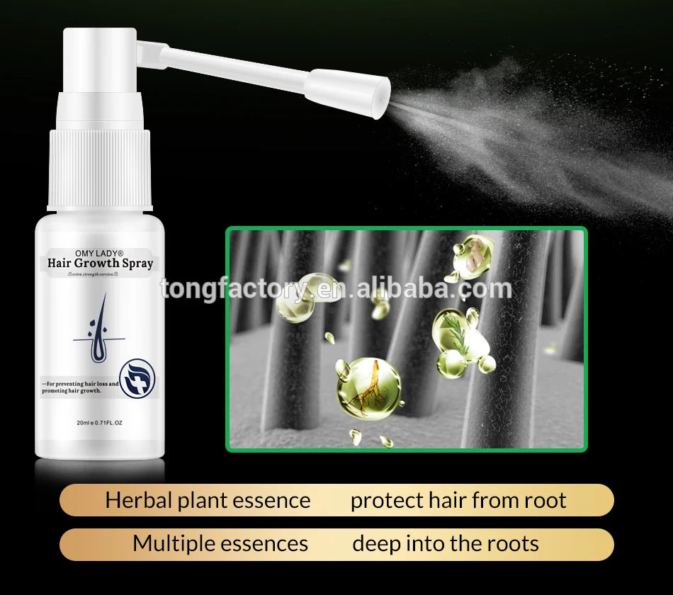 Health Care Supplies OMYLADY Top Selling Organic Hair Growth Lotion Product Organic Hair Growth Spray