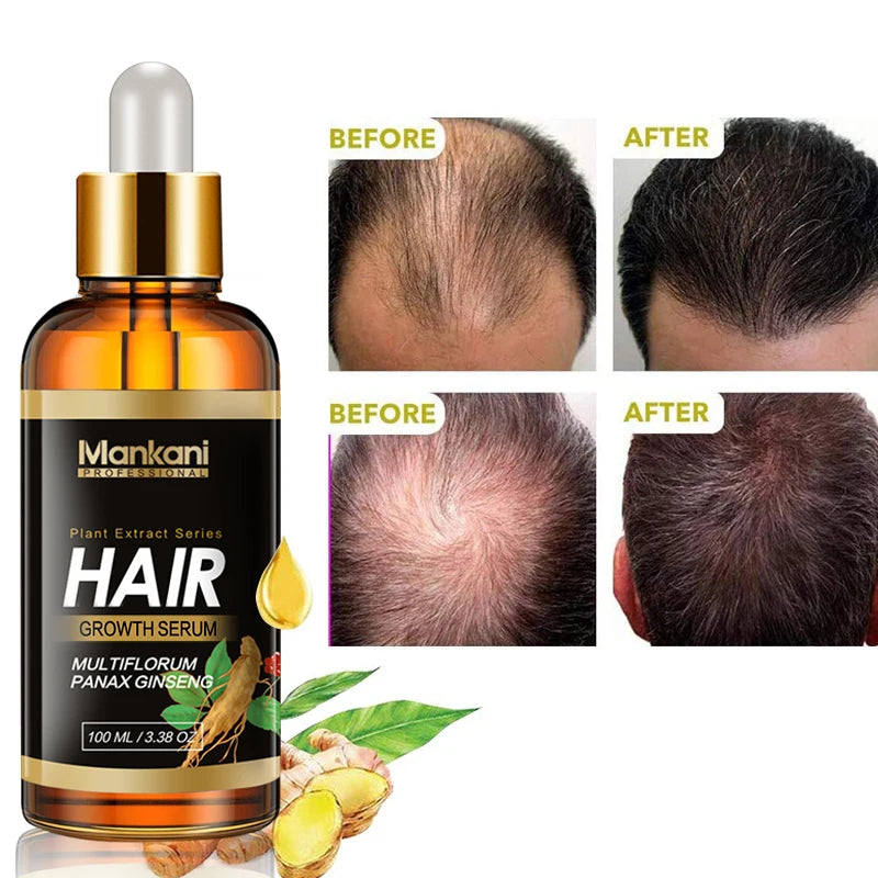 OEM Herbal Infused Argon Oil Hair Care Serum Private Label Natural Hair Growth Treatment Hair Growth Oil