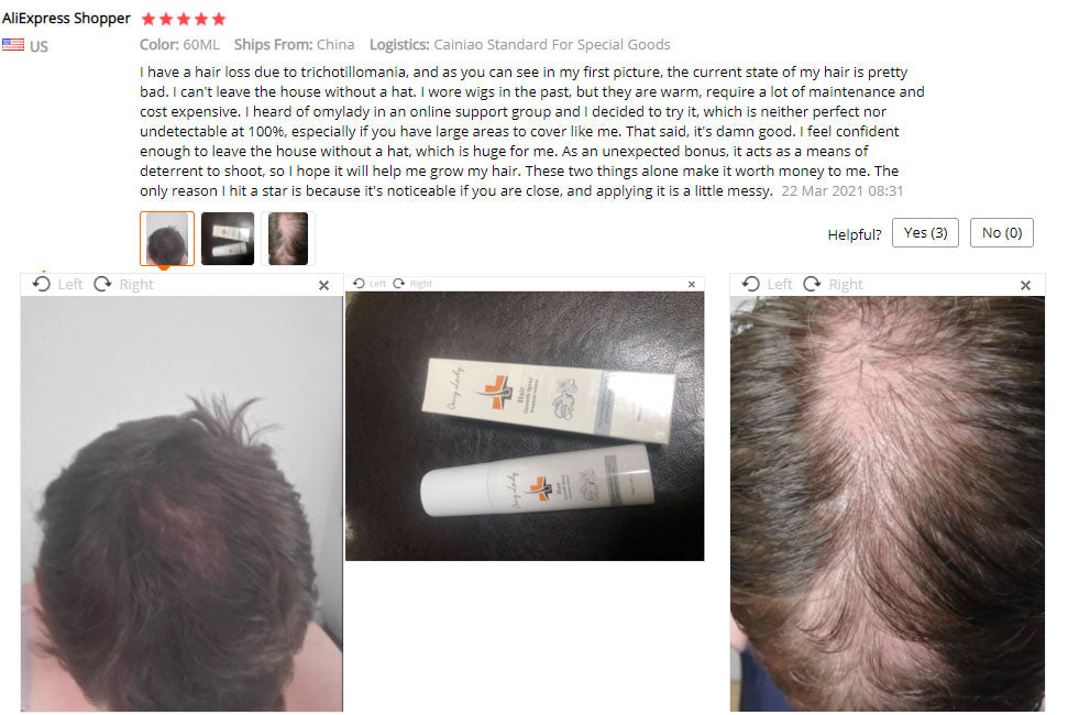 Other Men's Hair Care in USA OMY LADY Sample Free Treatment for Bald Hair Regrowth Serum