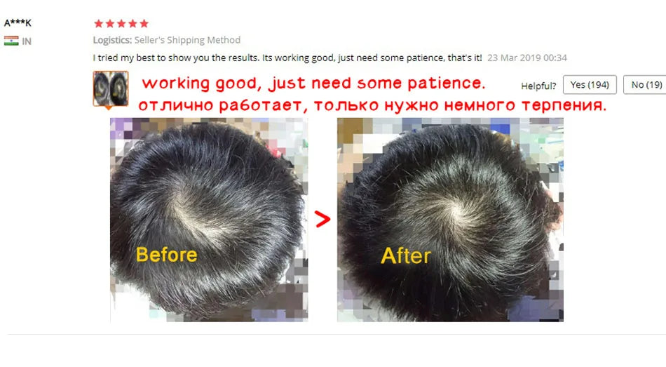 Health Care Supplies OMYLADY Top Selling Organic Hair Growth Lotion Product Organic Hair Growth Spray