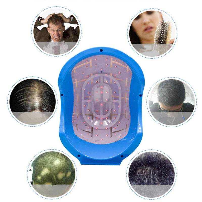 Fast Improve Bald Men Anti Hair Loss Care Laser Hair Regrowth Helmet LED Laser Hair Growth Helmet