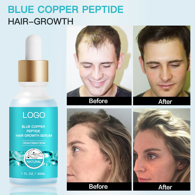 Low MOQ Hair Growth Serum Hair Care Line GHK-CU Blue Copper Peptide Hair Growth Serum Natural