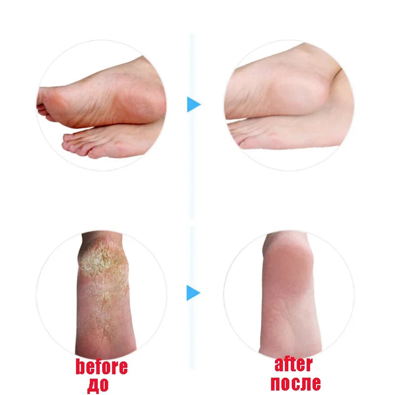 1 Pair Gel Sock Silicone Foot Care Tool Feet Protector Pain Relief Crack Prevention Moisturize Dead Skin Removal Sock With Hole