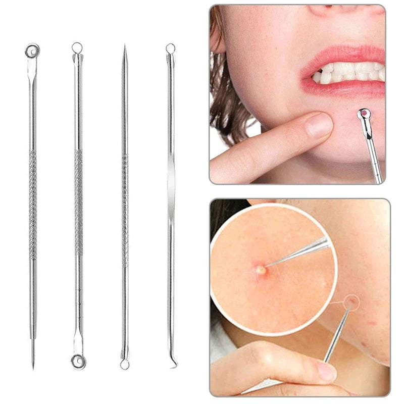 4pcs/Pack Blackhead Remover Tool Washable Stainless Steel Blackhead Extractor Face Pimple Cleaning Tools Skin Care Accessories