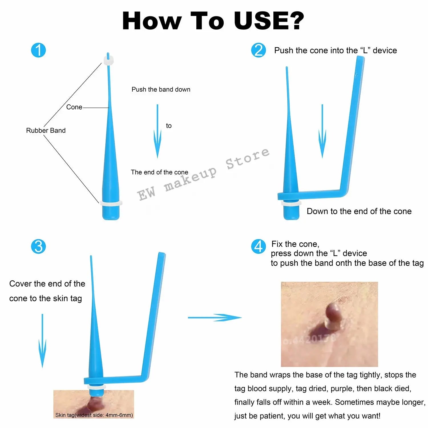 Micro Skin Tag Remover Remover Patch Mole Remover Kit Remove Acne Pimple Treatments Cleansing Swabs  Face Skin Care Beauty