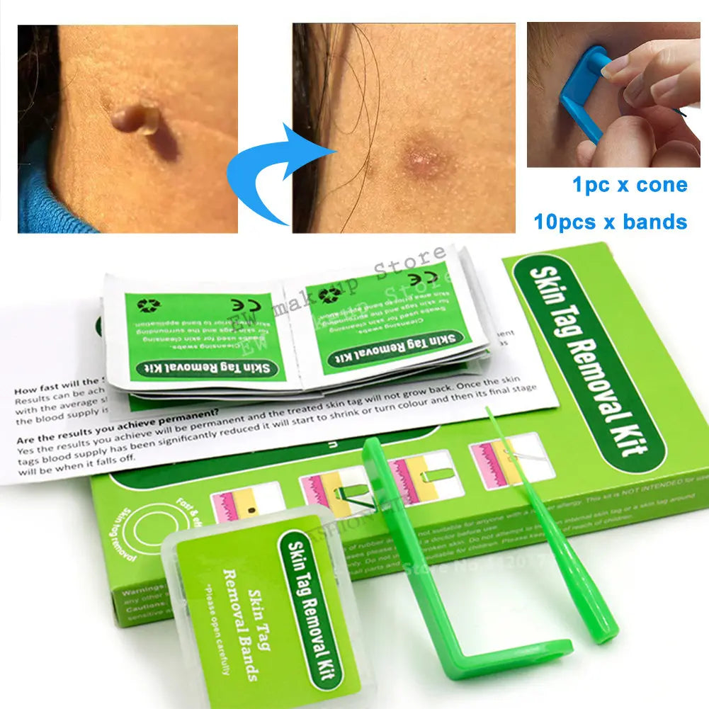 Micro Skin Tag Remover Remover Patch Mole Remover Kit Remove Acne Pimple Treatments Cleansing Swabs  Face Skin Care Beauty