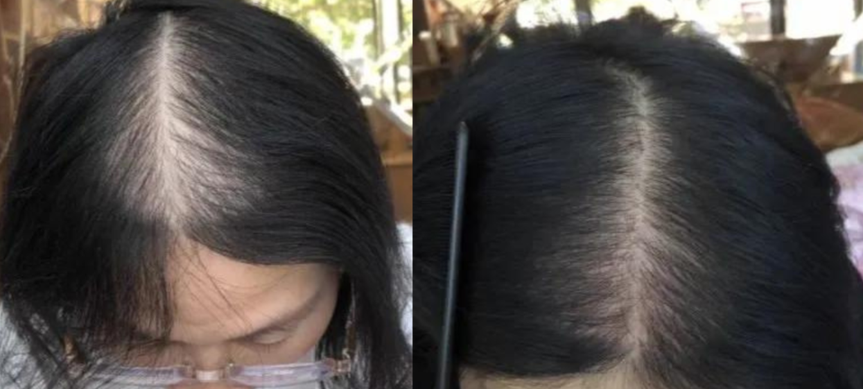 Hair Regrowth Oil - My Store